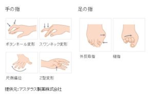 ライフスタイルの混乱